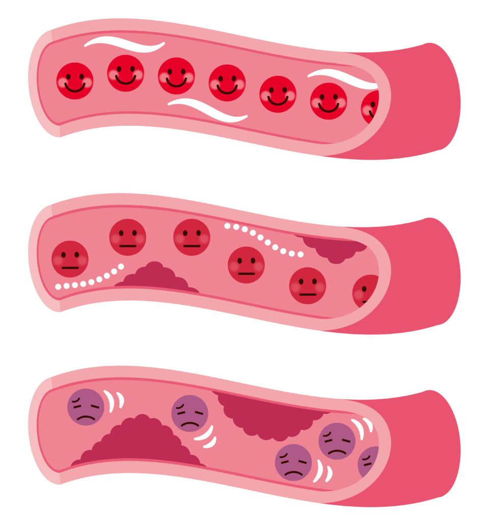 健康な髪のための血液をサラサラにする成分
